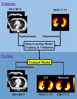 Deriving Pulmonary Ventilation Images From Clinical 4D-CBCT Using a Deep Learning-Based Model